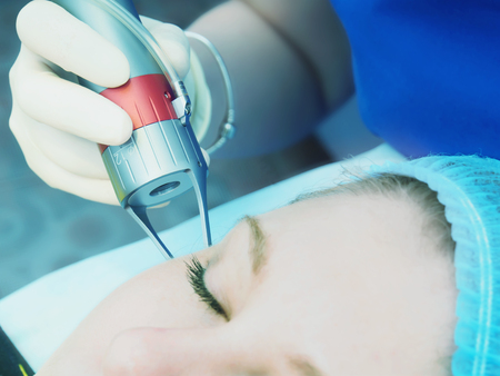 Microneedling Innovations: Latest Trends and Technology in the UK Market