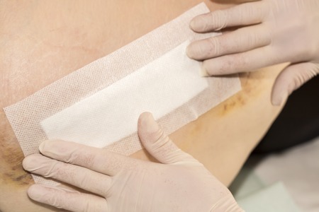 Potential Risks and Side Effects: What Brits Need to Know About Cryolipolysis