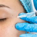 Addressing Misinformation: Common Myths About Hyperpigmentation Treatments in the UK