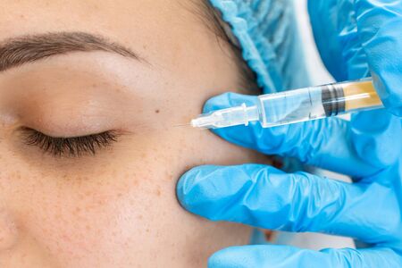 Addressing Misinformation: Common Myths About Hyperpigmentation Treatments in the UK