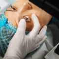 Exploring the Different Types of Radiofrequency Devices Used in UK Clinics